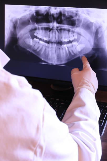 Best Emergency Dentist for Knocked-Out Tooth in Lakewood, IL